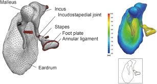 Image result for Ossicular Chain Disruption