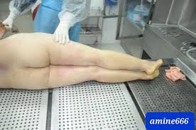 Examination corpse of dead Chinese prostitute killed by strangulation. |  theYNC