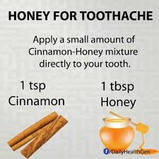 Pin On Home Remedies