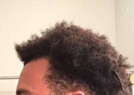 There are reasons other than cancer for this to happen, but one way or another that hair follicle has become less healthy, and you should probably talk to your doctor about that. Any Idea On Why My Hair Is Growing Like This Blackhair