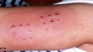 Trichomoniasis Paw Print Tattoo Paw Print Print Tattoos