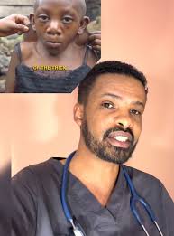 Sindrome De Turner En Famosos