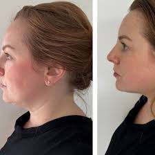 I tried 3 different facial workout treatments to see if they could sculpt  and tone my face'