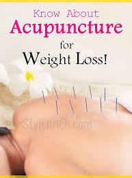 Pin On Acupuncture Procedure