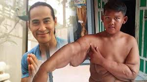 Kapolda sumsel minta maaf terkait kegaduhan donasi bodong rp 2 triliun dari keluarga akidi tio. Ade Rai Ungkap Perubahan Perilaku Arya Permana Yang Berat Badannya Susut 109 Kg Tribunnews Com Mobile