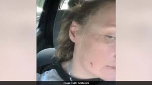 It Was Either Me Or The Cat": US Woman Kills Rabid Bobcat With Bare Hands