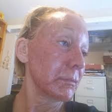 Roy A. David, MD, Board Certified Facial Plastic Surgeon