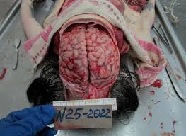 Female Literally Peeled Down in Morgue - LiveGore.com