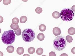 Image result for Peripheral Smear