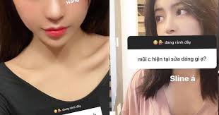 Trang Anna lần đầu chia sẻ chuyện phẫu thuật thẩm mỹ, hot girl có màn dao  kéo thành công nhất là đây chứ đâu!