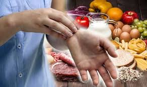 All three are present in cookies and milk. Eczema Treatment Cutting Down On Eggs And Cows Milk May Reduce Flare Ups Express Co Uk