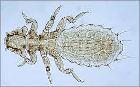 The close physical relationship between a parasite and its host could facilitate we designed a protocol to differentiate between contamination and horizontal transfer with by knowing the organisms involved in htt, including parasites and pathogens, we will. Difference Between Parasite And Bacteria Compare The Difference Between Similar Terms