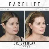 TOP 10 BEST Mommy Makeover near UCLA, Los Angeles, CA