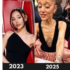 Ariana Grande's Health and Weight Loss Concerns