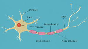 What Is Guillain Barre Syndrome Symptoms Causes Diagnosis Treatment And Prevention Everyday Health