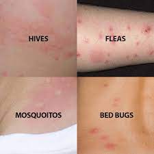 How To Tell If I Have Bed Bugs Baltimore Bed Bug Exterminator