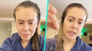 This means that it affects celebrities just as much as everyone else. Alyssa Milano Reveals Shocking Hair Loss From Covid 19 Youtube
