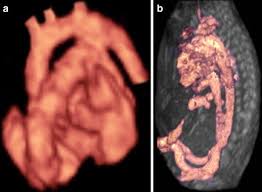 The baby has had time to build up body fat, but still has room to move around. Current 3d 4d Ultrasound Technology In Prenatal Diagnosis Springerlink