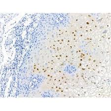 Purified by protein a affinity chromatography. Npm1 Antibody Elisakit Net