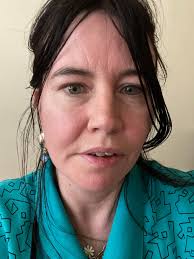 Idk if this is related or not, but since I had my surgery Monday, my right  cheek will get super hot to the touch and red. Has anyone experienced this?  Is it