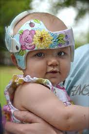 Whitney S Cranial Band Handpainted By Treasured Interiors Www Treasuredinteriors Net Doc Band Baby Helmet Cranial Band