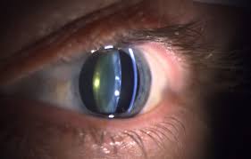 Das Gesunde Auge Institut Fur Augenheilkunde