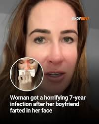 A TikToker and seven-year sinus infection sufferer suspects she originally  developed the issue from a heinous fart courtesy of her ex. According to  traveler Christine Connell, the man unleashed the nightmare gas