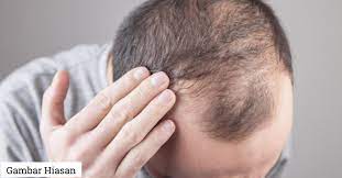 Stres rambut beruban awal telah dikaitkan dengan stres oleh para ahli. Stres Bila Rambut Gugur Di Usia Muda Ini Antara Puncanya Termasuklah Gayakan Rambut Secara Berlebihan