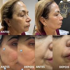 Estética Avançada em Três Pontas