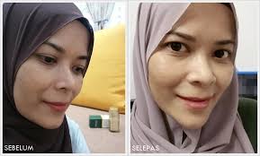 194946 likes 29 talking about this. Royale Nu Diamant Serum Plus Produk Terbaik Rawat Jeragat Dengan Berkesan Blog Lea Azleeya