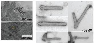 Image result for Filoviridae