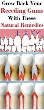 Receding Gums Gum Health Receding Gums Teeth Health