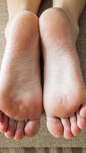 Tulang telapak tangan atau juga bisa disebut dengan tulang metakarpal terdiri dari lima ruas tulang yang berartikulasi atau menyambung dengan tulang karpal di 1. Fungsi Tulang Jari Kaki Yang Wajib Diketahui Lengkap Dengan Cara Menjaganya Merdeka Com