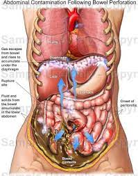 The abdomen is the largest cavity in the body. Human Abdomen Anatomy Anatomy Drawing Diagram
