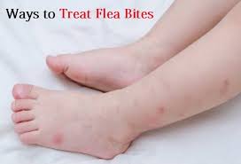 Bed Bug Bites That Look Like Mosquito Bites Pin On Home Remedies