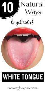 10 Ways To Get Rid Of White Tongue And Make It Healthier Whitetongue Homeremedies Natural Best Oralcare Oralcareathome White Tongue Tongue Tongue Cleaner