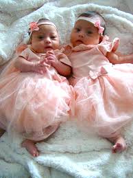 Mom Shares The Joy Of Raising One In A Million Identical Twins With Down Syndrome