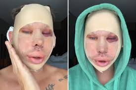 I ignored 'harmless' bloating for months until it was too late