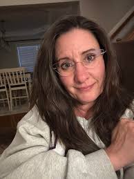 I have grey hair. Lots of it. I have wrinkles…everywhere. I have lost  elasticity in my skin. I have new red patches