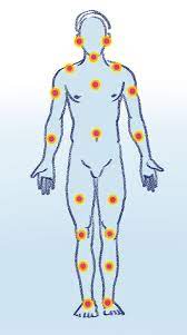 Symptome Fibromyalgie Schub