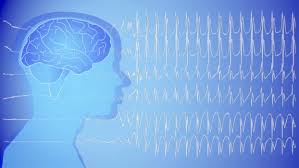 Epilepsi Sara Doktor Amcam