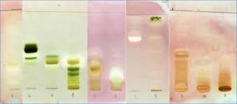 Image result for Oxyanthus speciosus