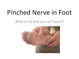 How To Get Rid Of Pinched Nerve In Foot Pinched Nerve Pinched Nerve Relief Nerve Relief