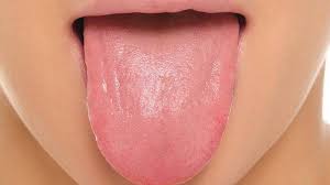 سرطان اللسان الأسباب وطرق الوقاية والعلاج مستشفيات مغربي