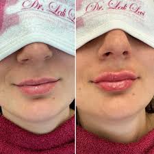 𝓓𝓻.𝓛𝓪𝓵𝓲 𝓛𝓮𝓿𝓲📞0523778809 (@dr.lali_levi) • Instagram photos and  videos