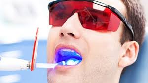 We did not find results for: 6 Foods You Should Avoid After Teeth Whitening Yeg Fitness