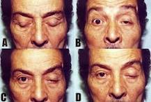 Image result