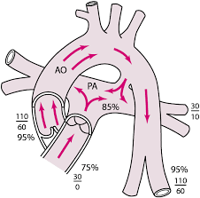 The individual issues of the journal each deal with specific topics and comprise review articles in english. Persistierender Ductus Arteriosus Botalli Pda Padiatrie Msd Manual Profi Ausgabe