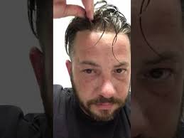 If you enjoy the look and feel of the best hair replacement system for men on the market, then we also set you up with regular replacements so that you have. Hair Replacement Men S Hair System Review 3 Months The Bad Youtube
