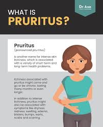 Pruritus Causes Risk Factors 5 Natural Treatments Dr Axe Itchy Skin Conditions Itchy Skin Itching Skin